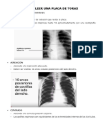 Como Leer Una Placa de Torax y Estructuras Basicas Anatomicas