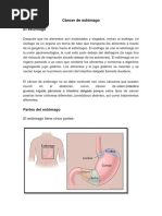 Cáncer de Estómago