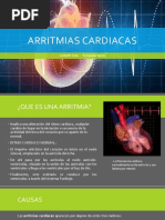 Arritmias Cardiacas 1