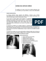 Lesiones Del Espacio Aéreo-Imagen