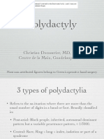 Polydactyly: Christian Dumontier, MD, PHD Centre de La Main, Guadeloupe, Fwi