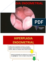 Hiperplasia Endometrial