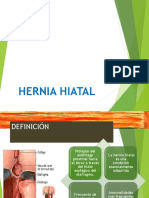 Presentacion Hernia Hiatal