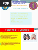 Carcinoma Pulmonar