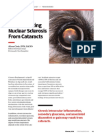 ProP - Differentiating Nuclear Sclerosis From Cataracts