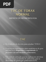 Tac de Torax Normal 17