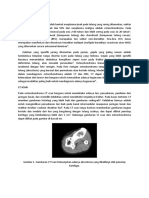 Referat Osteochondroma Kamila Rahmah