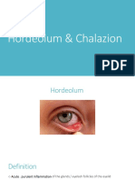 Hordeolum & Chalazion