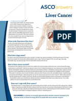 What Is Liver Cancer?