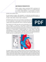 4.19 Conducto Arterioso Persistente