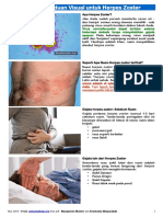 Sebuah Panduan Visual Untuk Herpes Zoster - WebMD