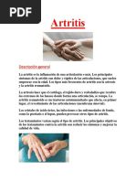 Cura para La Astritis PDF GRATIS.