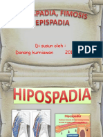 Hipospadia Fimosis Epispadia