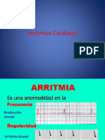 Arritmias Cardiacas