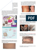 ESCABIOSIS