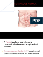 Enterocutaneous Fistula