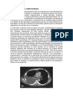 Derrame Pleural Por Tomografía