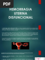 Hemorragia Uterina Disfuncional