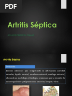 Artritis Septica