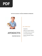 Apendicitis