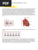 ECG Electrode Placement