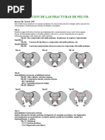 Clasificacion de Las Fracturas de Pelvis