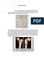 Fractura de Tercio Medio de Femur