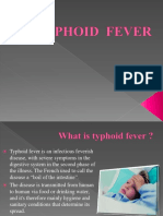 Typhoid Fever