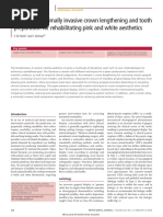 Al-Harbi - 2018 - A Guide To Minimally Invasive Crown Lengthening and Tooth Preparation For Rehabilitating Pink and White Ae