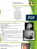 Radiografia de Craneo Proyecciones