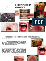 10.metodos de Identificacion Odontologica