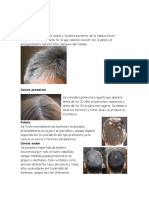 Tipos de Canas