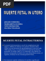 Muerte Fetal in Utero