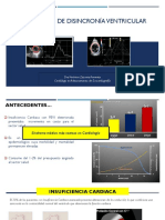 Disincronía Ventricular