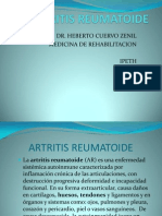 Artritis Reumatoide