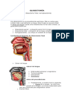 GLOSECTOMÍA