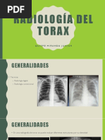 Radiología Del Torax