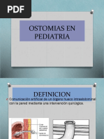 Ostomias