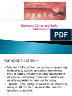 Ecc and Rampant Caries