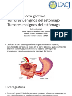 Ulcera Gástrica, Tumores Malignos y Benignos Gastricos