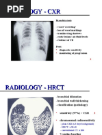 Bronchiectasis 2