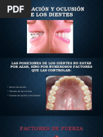 Hipercementosis y Anquilosis