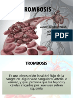 TROMBOSIS