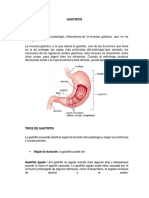 Gastritis