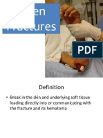 Management of Open Fractures