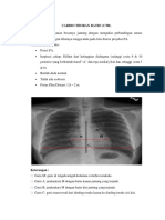 Cardio Thorax Ratio Ners Iccu