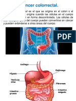 Cancer Colorrectal