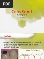 Caries Kelas 5