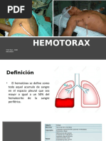 HEMOTORAX