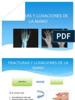 Fracturas y Luxaciones de La Mano